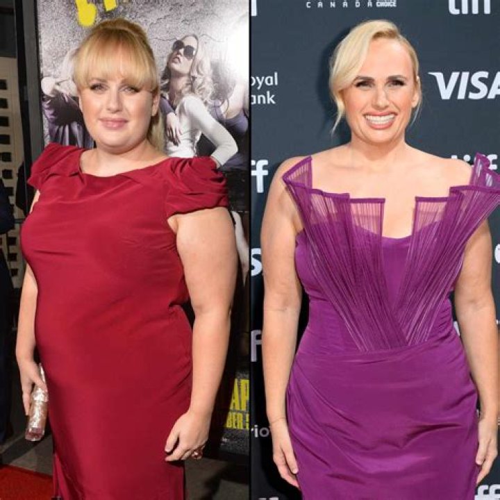 RHOBH: Kathy Hilton Weight Loss – Before And After Photos, Diet And Workout